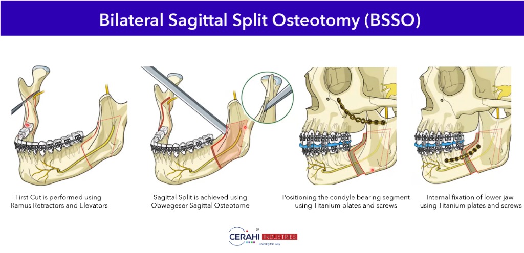 Maxillofacial Surgical Sets: Comprehensive Surgeon's Guide, Technical Specs & Compliance Standards